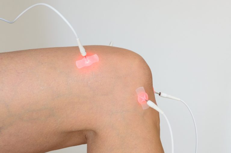 All You Need to Know about Muscle Stimulation Therapy